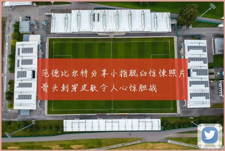 范德比尔特分享小指脱臼惊悚照片骨头刺穿皮肤令人心惊胆战